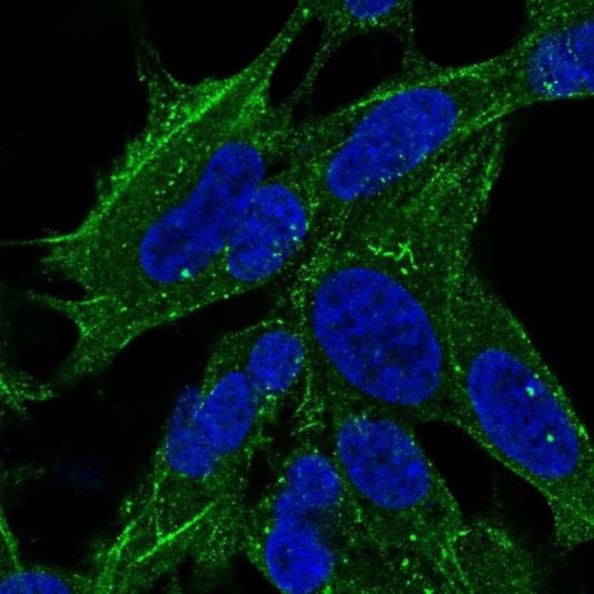 SYNPO2 Antibody in Immunocytochemistry (ICC/IF)