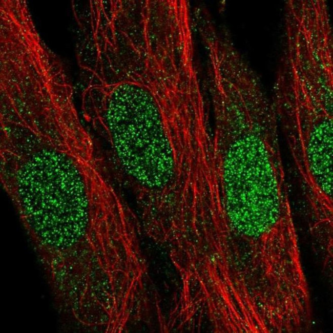 LDB2 Antibody in Immunocytochemistry (ICC/IF)