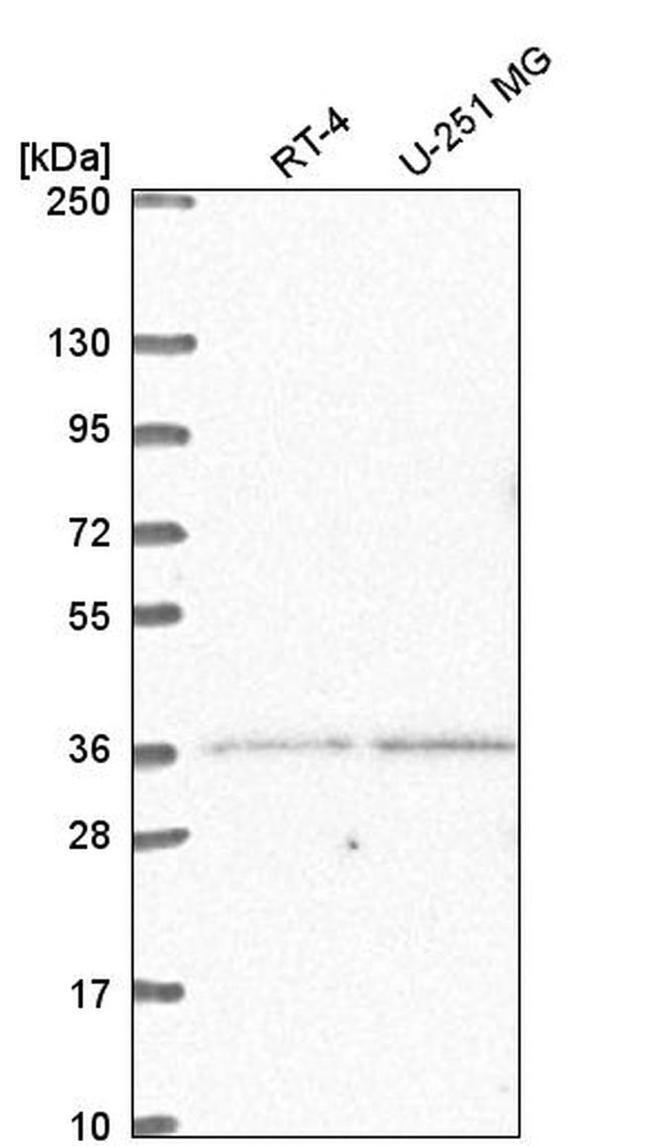 LDB2 Antibody in Western Blot (WB)