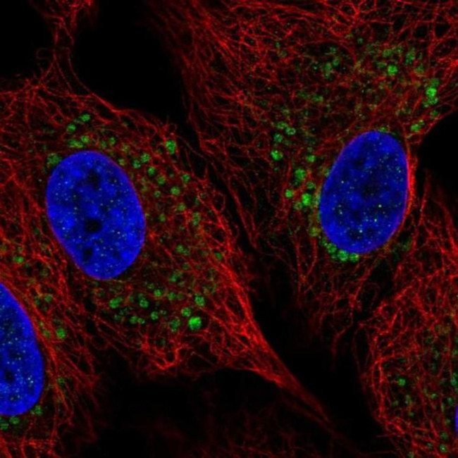 ZDHHC11B Antibody in Immunocytochemistry (ICC/IF)