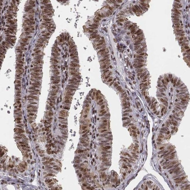 LUC7L Antibody in Immunohistochemistry (IHC)