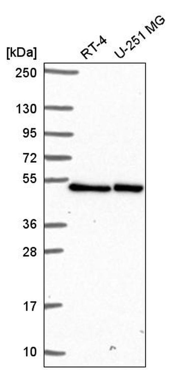 LUC7L Antibody in Western Blot (WB)