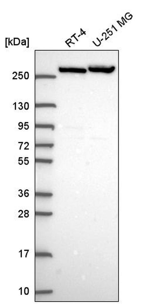 CAD Antibody in Western Blot (WB)