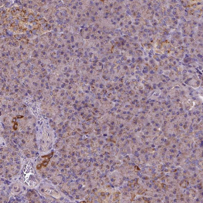 WARS2 Antibody in Immunohistochemistry (IHC)