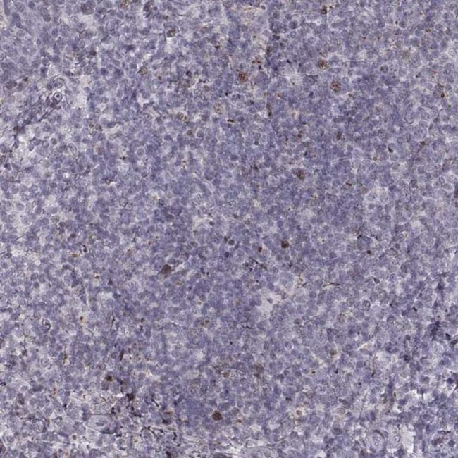 TMEM48 Antibody in Immunohistochemistry (IHC)