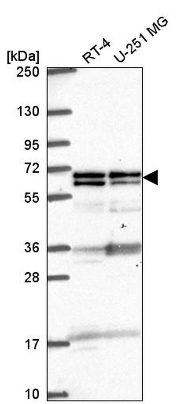 GTF3C5 Antibody in Western Blot (WB)