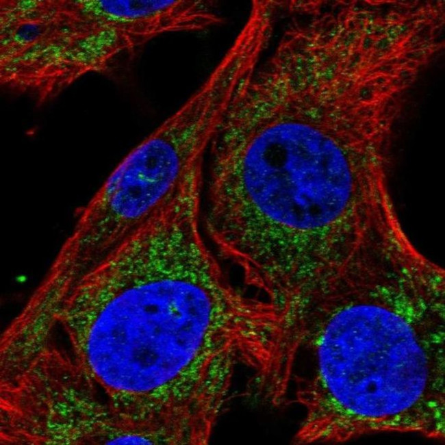 SLC25A34 Antibody in Immunocytochemistry (ICC/IF)