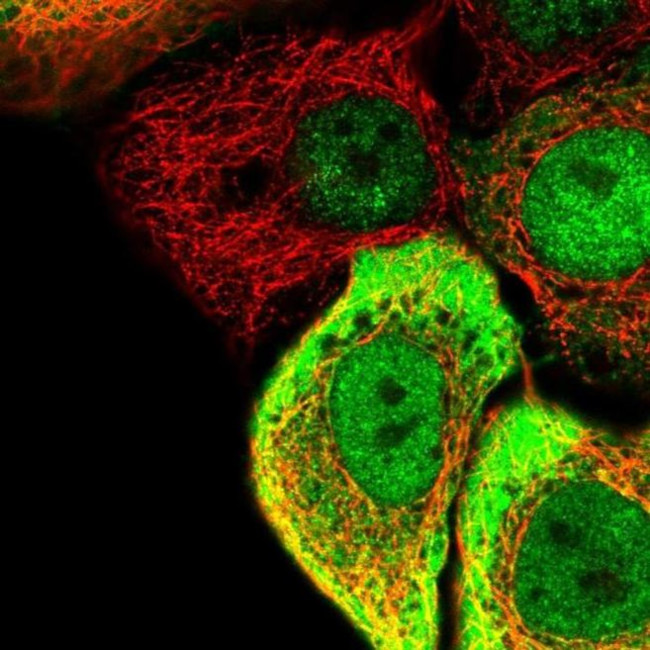 SC5D Antibody in Immunocytochemistry (ICC/IF)