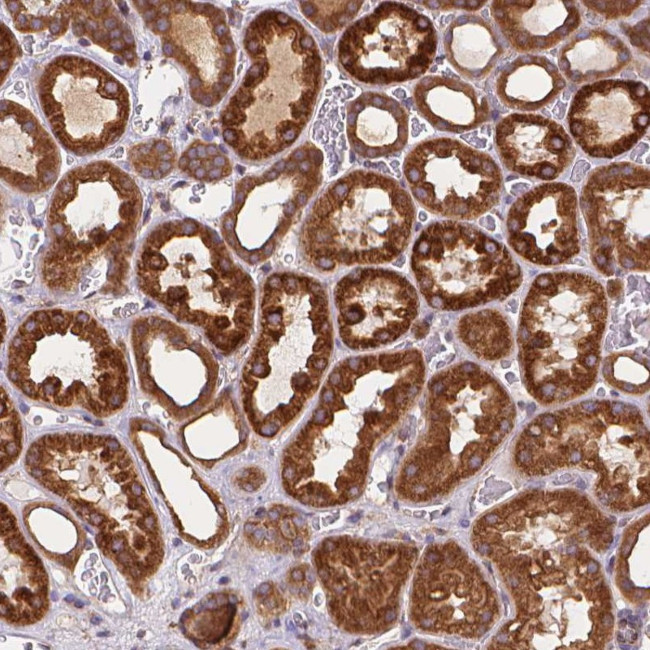 ARAP1 Antibody in Immunohistochemistry (IHC)