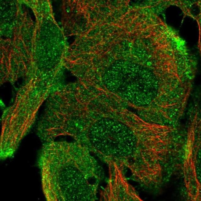 ARAP1 Antibody in Immunocytochemistry (ICC/IF)