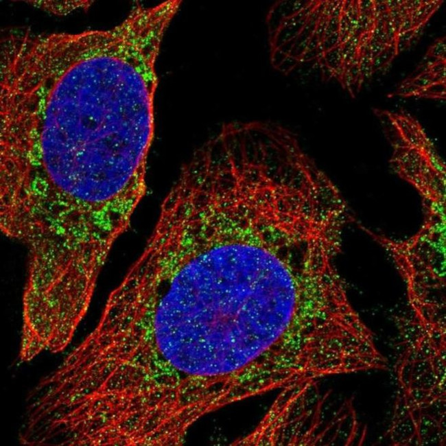 PDPR Antibody in Immunocytochemistry (ICC/IF)