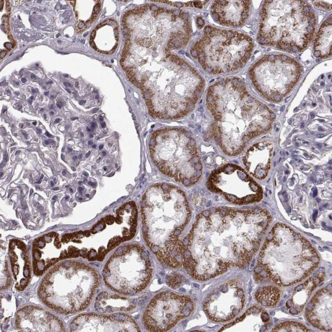 ATP5J2 Antibody in Immunohistochemistry (IHC)