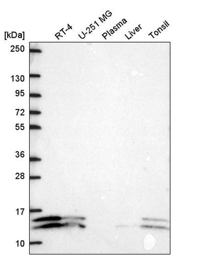 ATP5J2 Antibody in Western Blot (WB)