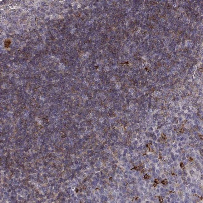 Cyclin F Antibody in Immunohistochemistry (IHC)