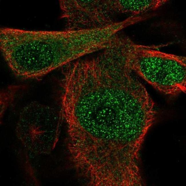 SSU72 Antibody in Immunocytochemistry (ICC/IF)