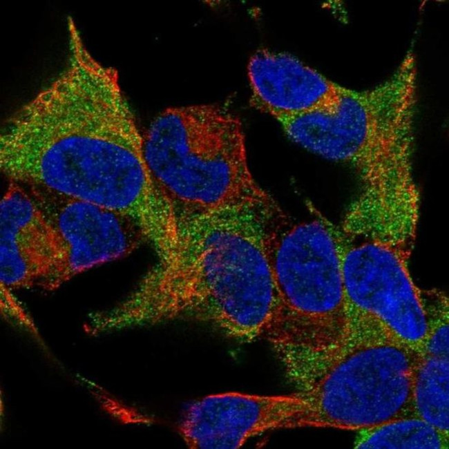 WIPF1 Antibody in Immunocytochemistry (ICC/IF)