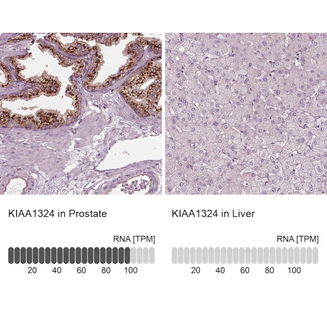 KIAA1324 Antibody in Immunohistochemistry (IHC)
