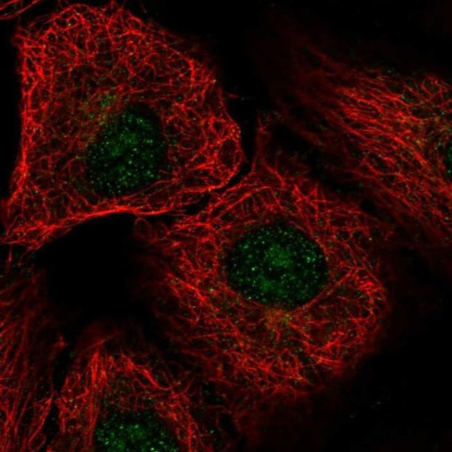 DDX54 Antibody in Immunocytochemistry (ICC/IF)