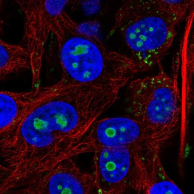 ACSL3 Antibody in Immunocytochemistry (ICC/IF)