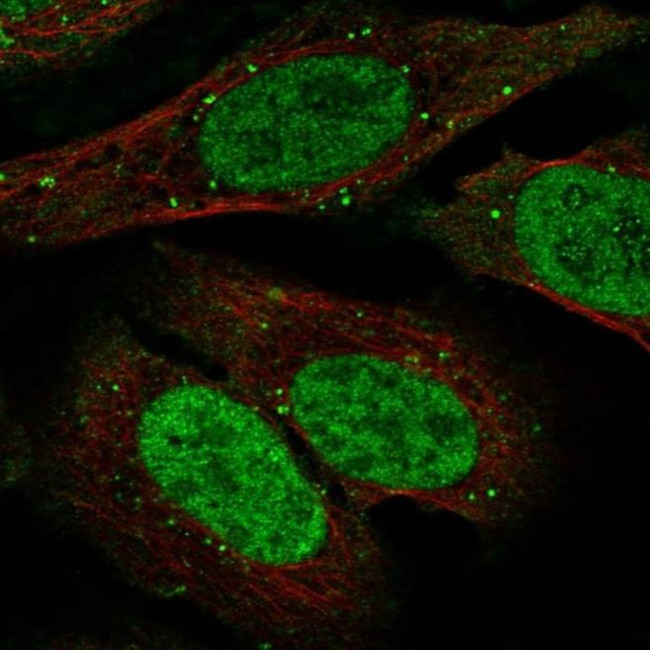 TDP1 Antibody in Immunocytochemistry (ICC/IF)