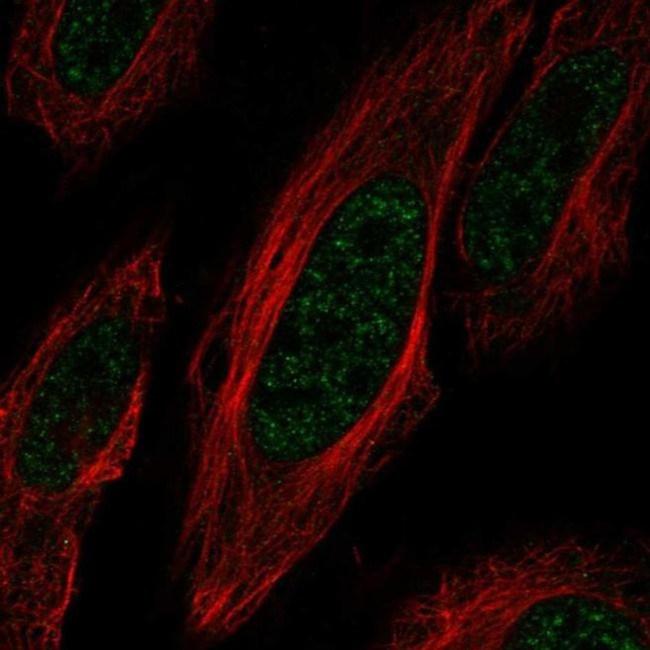 ZNF621 Antibody in Immunocytochemistry (ICC/IF)