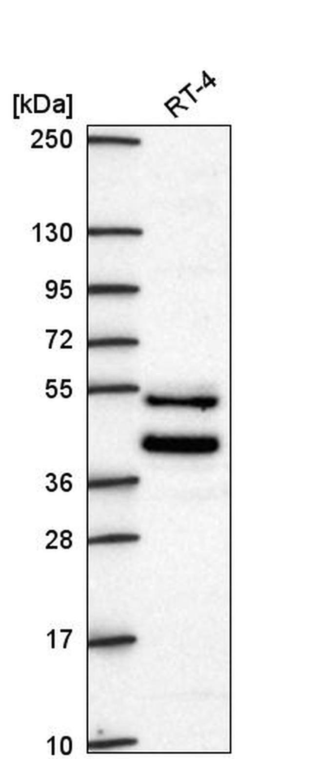 ZNF621 Antibody in Western Blot (WB)