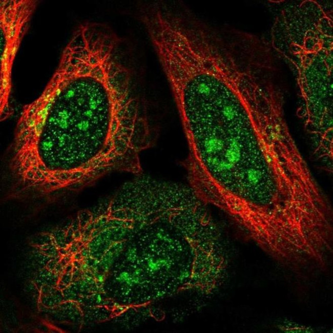 DOCK4 Antibody in Immunocytochemistry (ICC/IF)