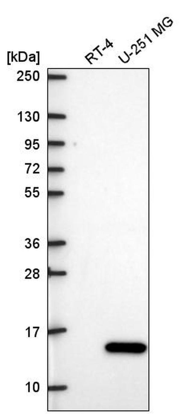 ITGB1BP1 Antibody in Western Blot (WB)