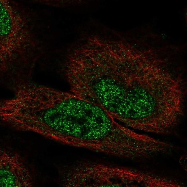 FGF12 Antibody in Immunocytochemistry (ICC/IF)