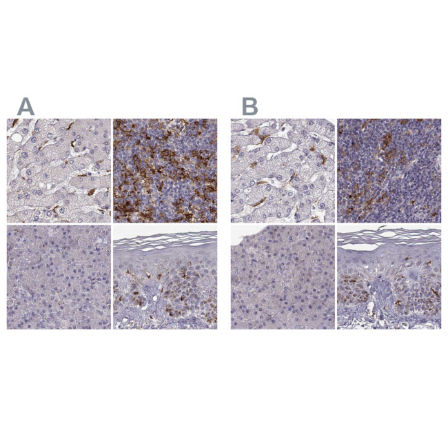 Cyclin F Antibody in Immunohistochemistry (IHC)