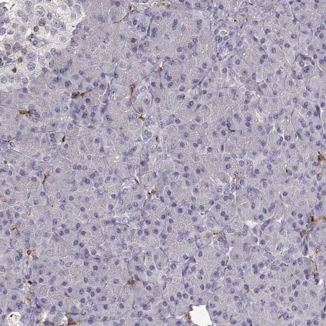 Cyclin F Antibody in Immunohistochemistry (IHC)