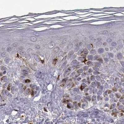 Cyclin F Antibody in Immunohistochemistry (IHC)