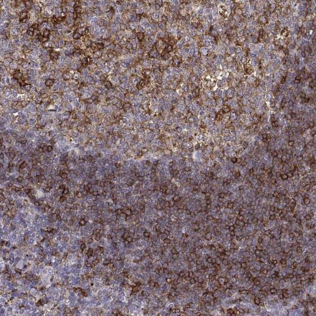 Cyclin F Antibody in Immunohistochemistry (IHC)