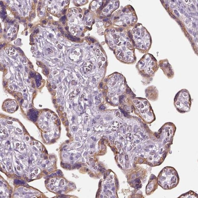 CHST14 Antibody in Immunohistochemistry (IHC)