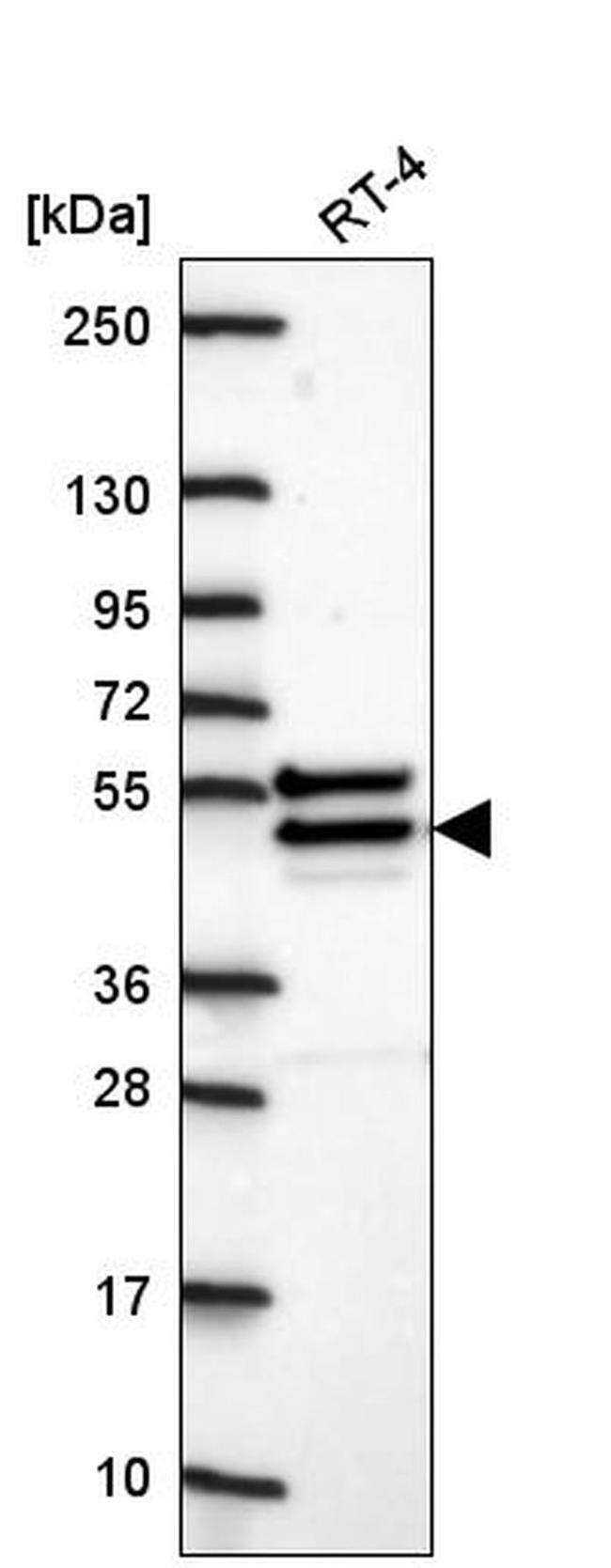 CHST14 Antibody in Western Blot (WB)