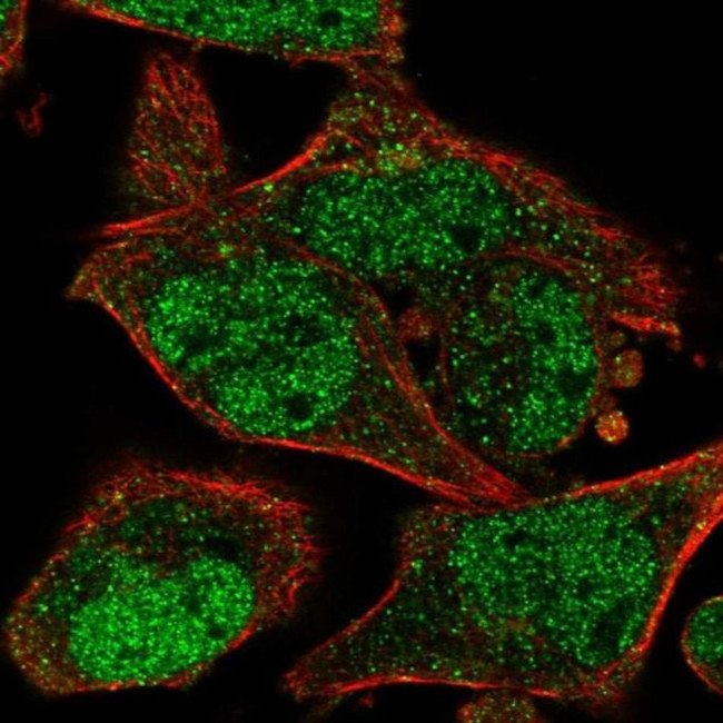 C14orf100 Antibody in Immunocytochemistry (ICC/IF)