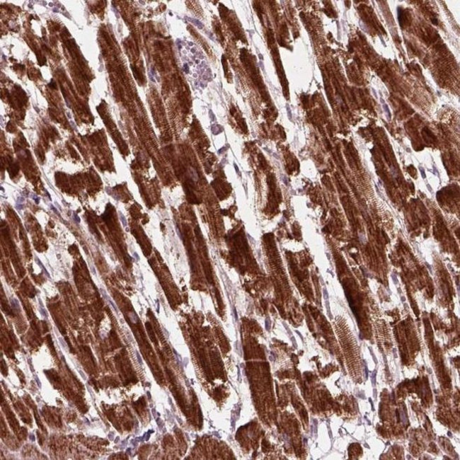 SLC25A5 Antibody in Immunohistochemistry (IHC)