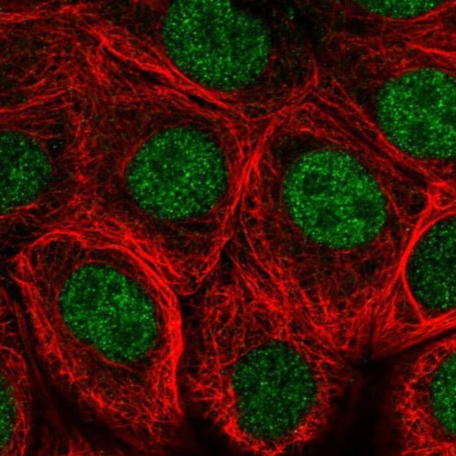 HB9 Antibody in Immunocytochemistry (ICC/IF)