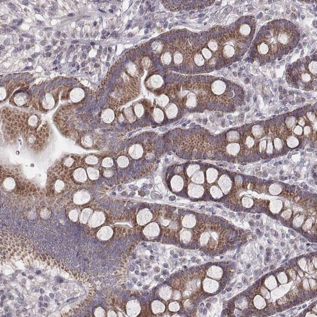 MRPS27 Antibody in Immunohistochemistry (IHC)