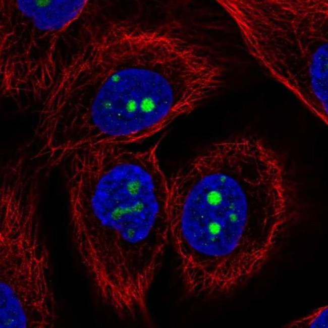 KCNJ14 Antibody in Immunocytochemistry (ICC/IF)