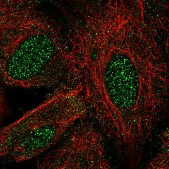 LHX8 Antibody in Immunocytochemistry (ICC/IF)