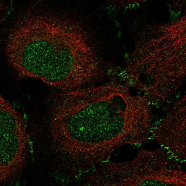 ZPK Antibody in Immunocytochemistry (ICC/IF)