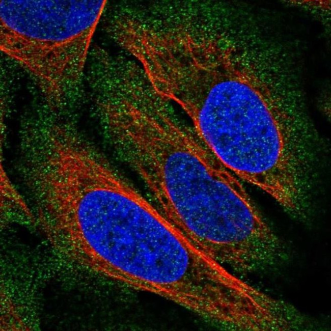 ZDHHC22 Antibody in Immunocytochemistry (ICC/IF)