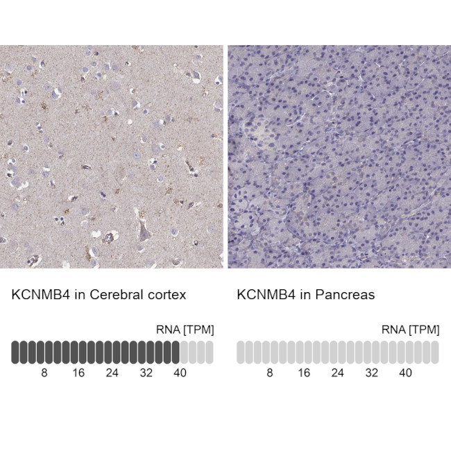 KCNMB4 Antibody in Immunohistochemistry (IHC)