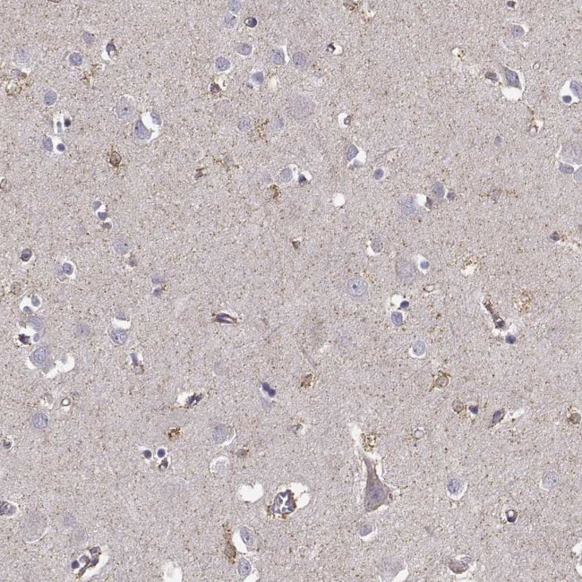 KCNMB4 Antibody in Immunohistochemistry (IHC)