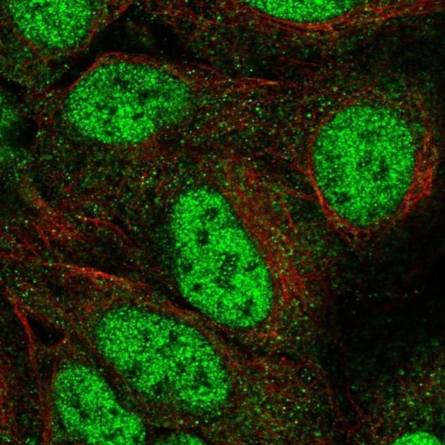 GOT1 Antibody in Immunocytochemistry (ICC/IF)