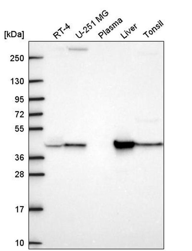 GOT1 Antibody in Western Blot (WB)