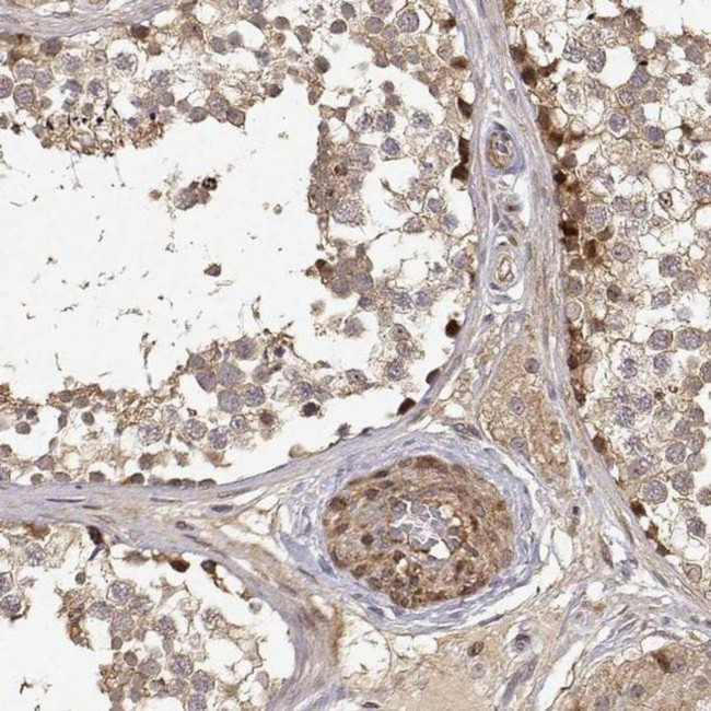 PICK1 Antibody in Immunohistochemistry (IHC)