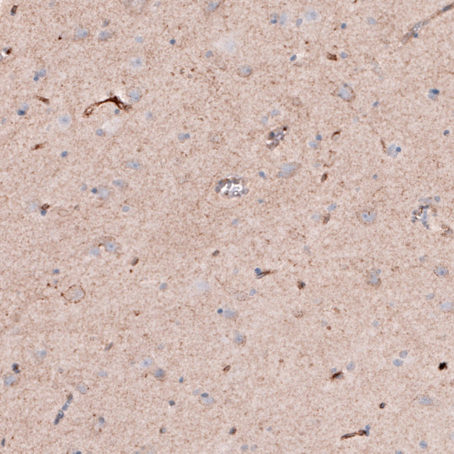 SLC16A2 Antibody in Immunohistochemistry (IHC)