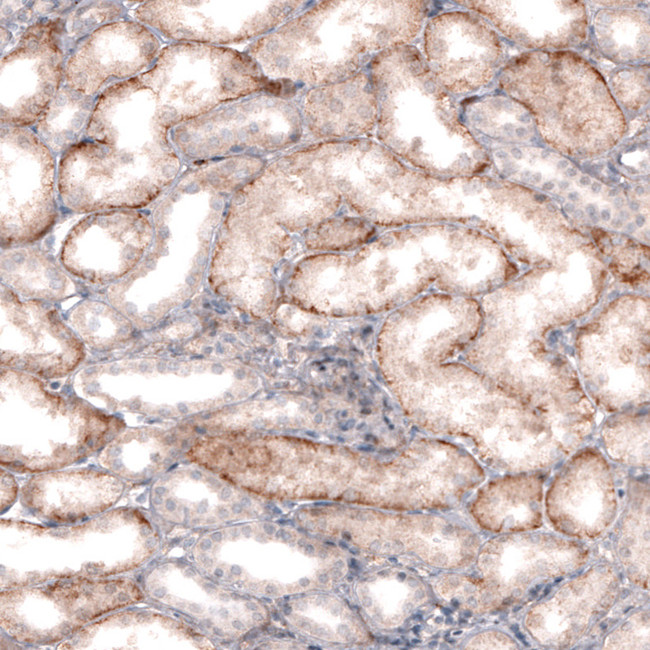 SLC16A2 Antibody in Immunohistochemistry (IHC)